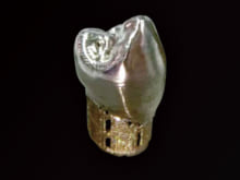 Artificial tooth